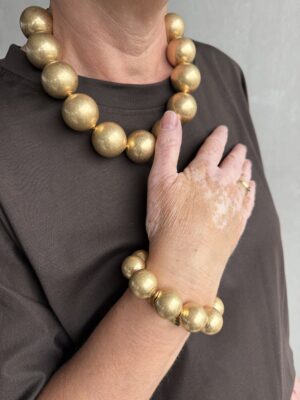 Armband